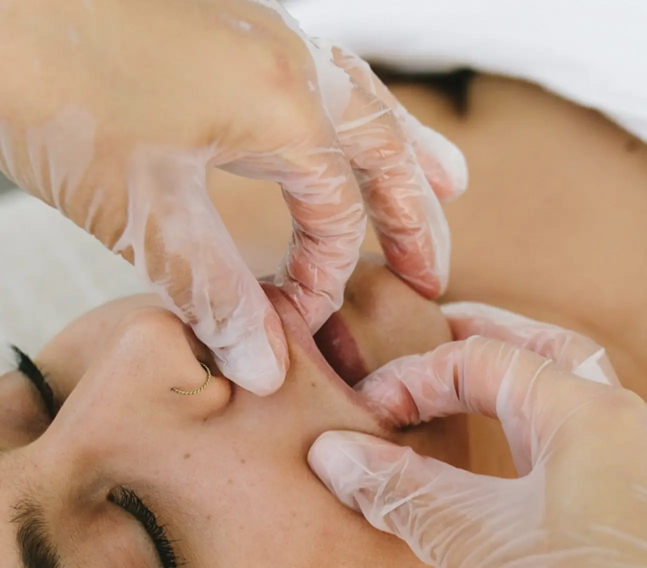 buccal massage in Brisbane